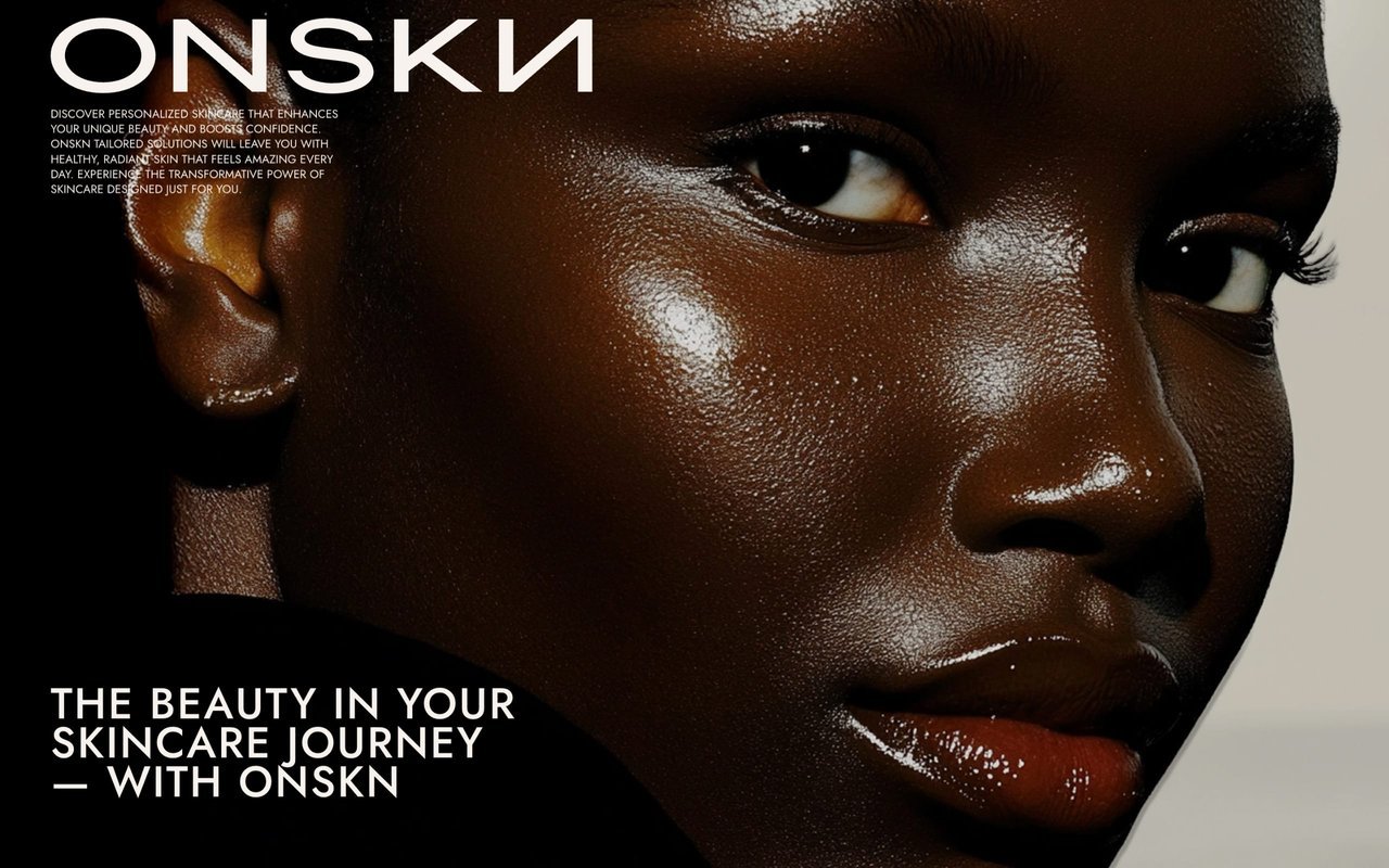 ONSKN
